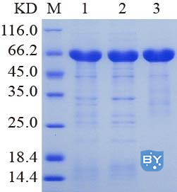 蛋白纯化SDS-PAGE分析